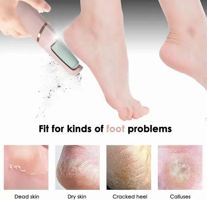 Foot Fix™ Callus Remover