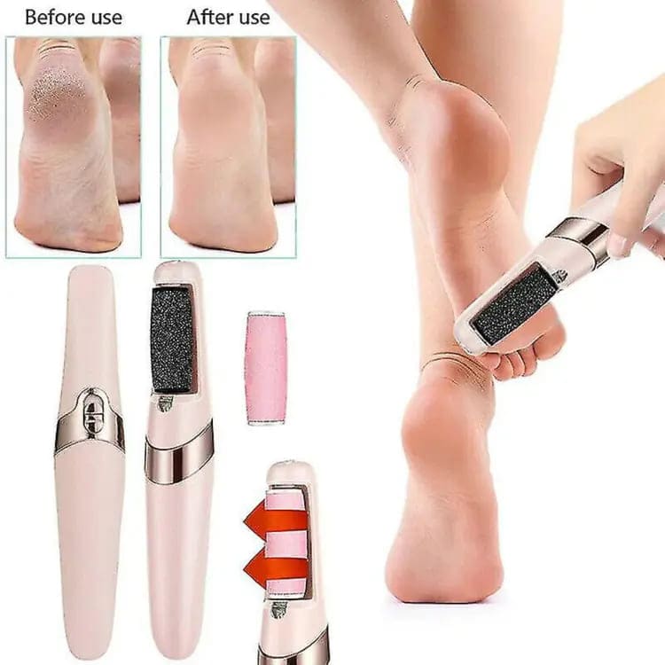 Foot Fix™ Callus Remover