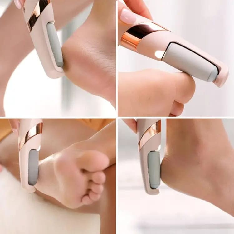 Foot Fix™ Callus Remover